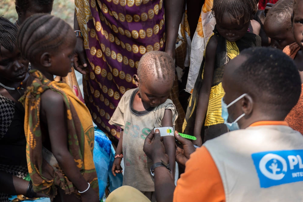 Checking a child for malnutrition